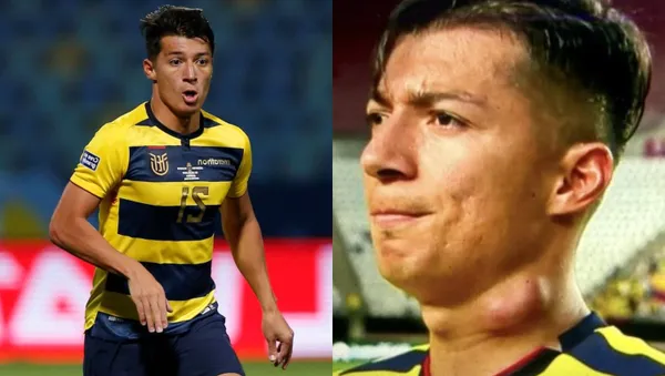 El jugador de la selección encendió las alarmas luego de que saliera con una protuberancia en el cuello
