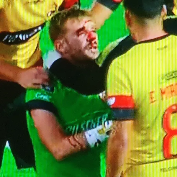 El portero ya está en el país recuperándose