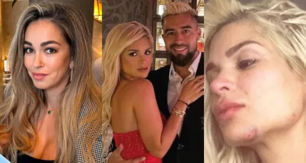 Keviam Cazo denunció agresión por parte de Christian Noboa pero su ex pareja decidió darle el espaldarazo