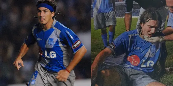 Le fracturaron el maxilar inferior en Emelec, así luce Trapito Vega