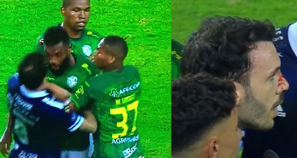 Sebastián Rodríguez sufrió un terrible cabezazo de Gabriel Achilier que le rompió la nariz. En los primeros informes resalta que el volante de Emelec desató la furia del de Orense porque se pasó de palabras porque estaba en caliente