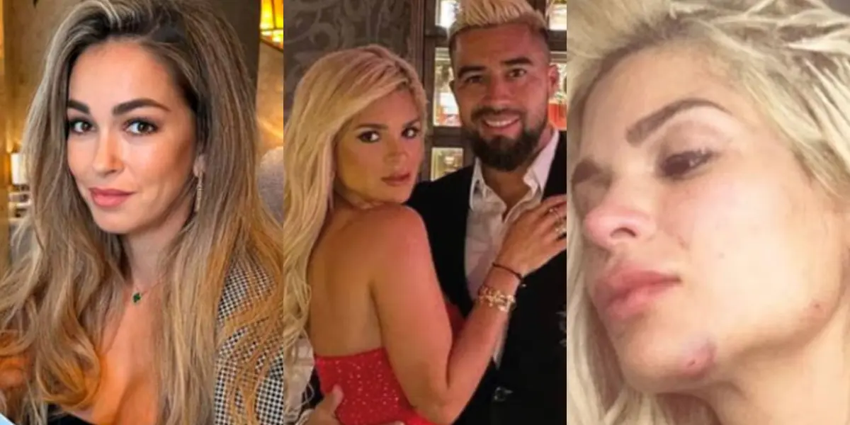 Keviam Cazo denunció agresión por parte de Christian Noboa pero su ex pareja decidió darle el espaldarazo